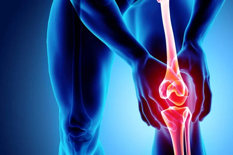 Knee Pain Relief in Kenya